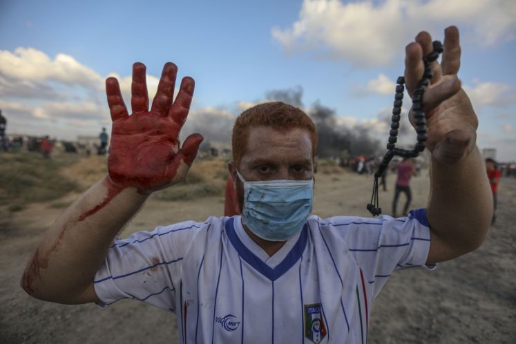 Ein palästinensischer Demonstrant zeigt bei Demonstrationen an der Grenze zu Israel seine blutige Hand. Der Konflikt zwischen Israel und der im Gazastreifen herrschenden Hamas ist gefährlich eskaliert. Am Freitag kam es entlang der Gaza-Grenze erneut zu Demonstrationen. Nach Augenzeugenberichten verbrannten Palästinenser Reifen, versuchten den Grenzzaun zu Israel zu beschädigen und schickten Brand-Drachen und -Ballons auf israelisches Gebiet
