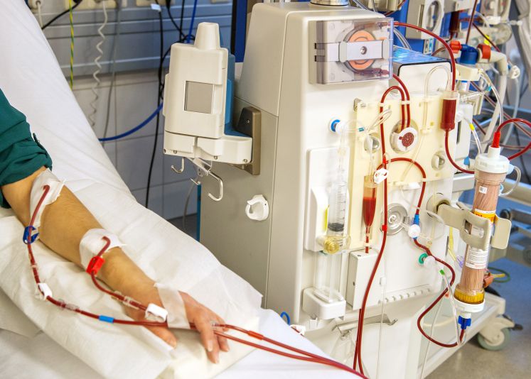 Ein Mädchen ist am 19.11.2013 im Kinderkrankenhaus der MHH Medizinische Hochschule Hannover (Niedersachsen) an ein Dialysegerät angeschlossen. Das junge Mädchen wartet auf eine Spenderniere. Rund 11 000 sterbenskranke Menschen warten bundesweit auf ein Spenderorgan. Auf der Warteliste der Vergabeorganisation Eurotransplant standen im Oktober auch 112 Kinder unter 16 Jahren allein aus deutschen Transplantationszentren.