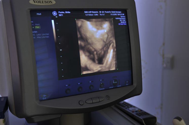 Ultraschall