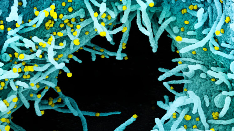Sars-Cov-2-Virus