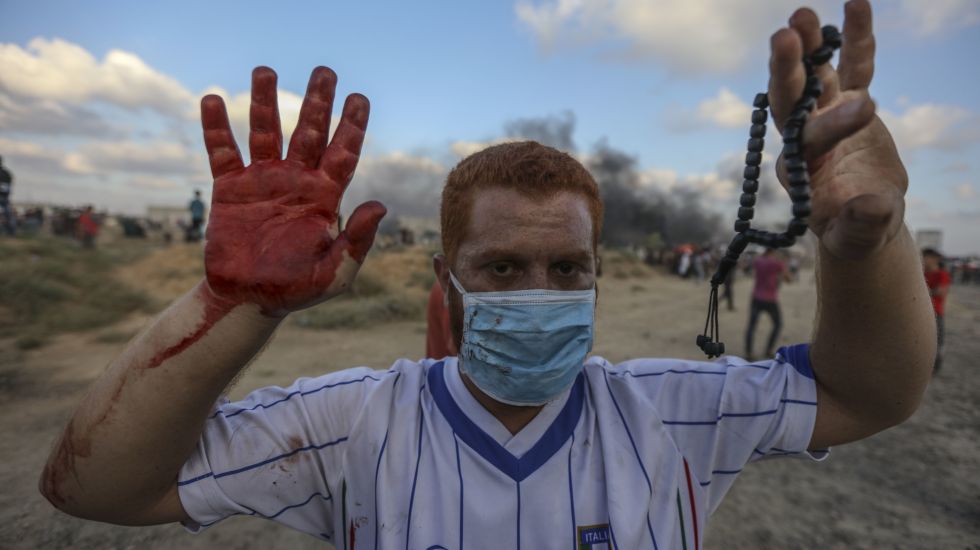 Ein palästinensischer Demonstrant zeigt bei Demonstrationen an der Grenze zu Israel seine blutige Hand. Der Konflikt zwischen Israel und der im Gazastreifen herrschenden Hamas ist gefährlich eskaliert. Am Freitag kam es entlang der Gaza-Grenze erneut zu Demonstrationen. Nach Augenzeugenberichten verbrannten Palästinenser Reifen, versuchten den Grenzzaun zu Israel zu beschädigen und schickten Brand-Drachen und -Ballons auf israelisches Gebiet